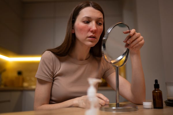 Common Monsoon Skin Concerns