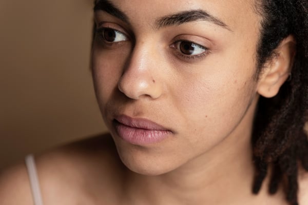 Dull and tired skin