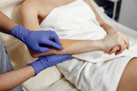 is laser hair removal better than waxing