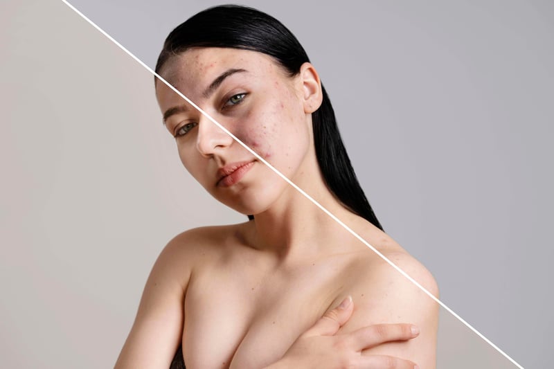PRP Facial Benefits on Face