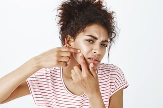 Pimple Mark Removal , Bodycraft Clinic