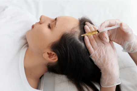GFC Hair Loss Treatment