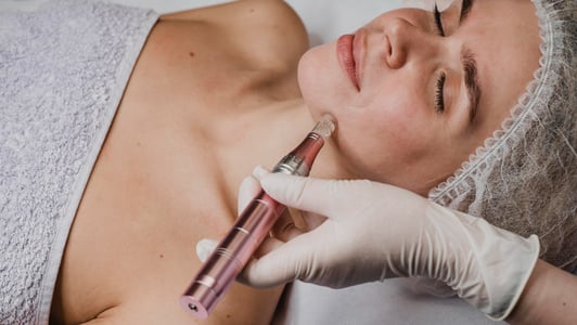 how to remove chicken pox marks