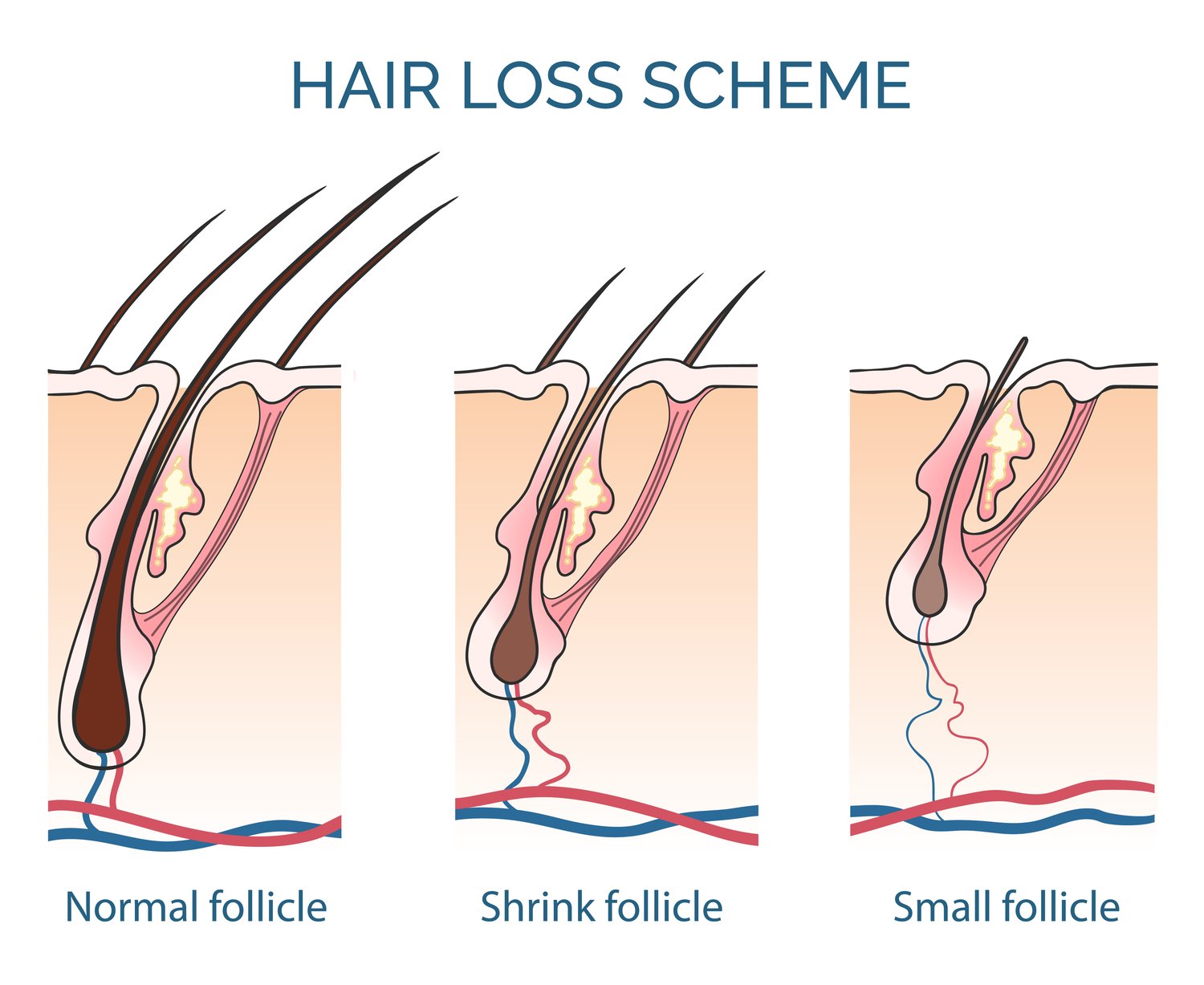 Hair Loss Got You Worried? Here's What You Should Know