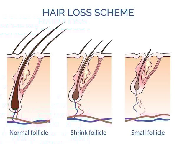 Let’s Understand Hair Loss First!