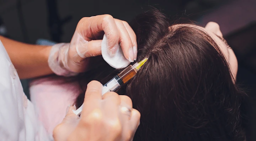 Hair specialist injecting GFC treatment into scalp with syringe