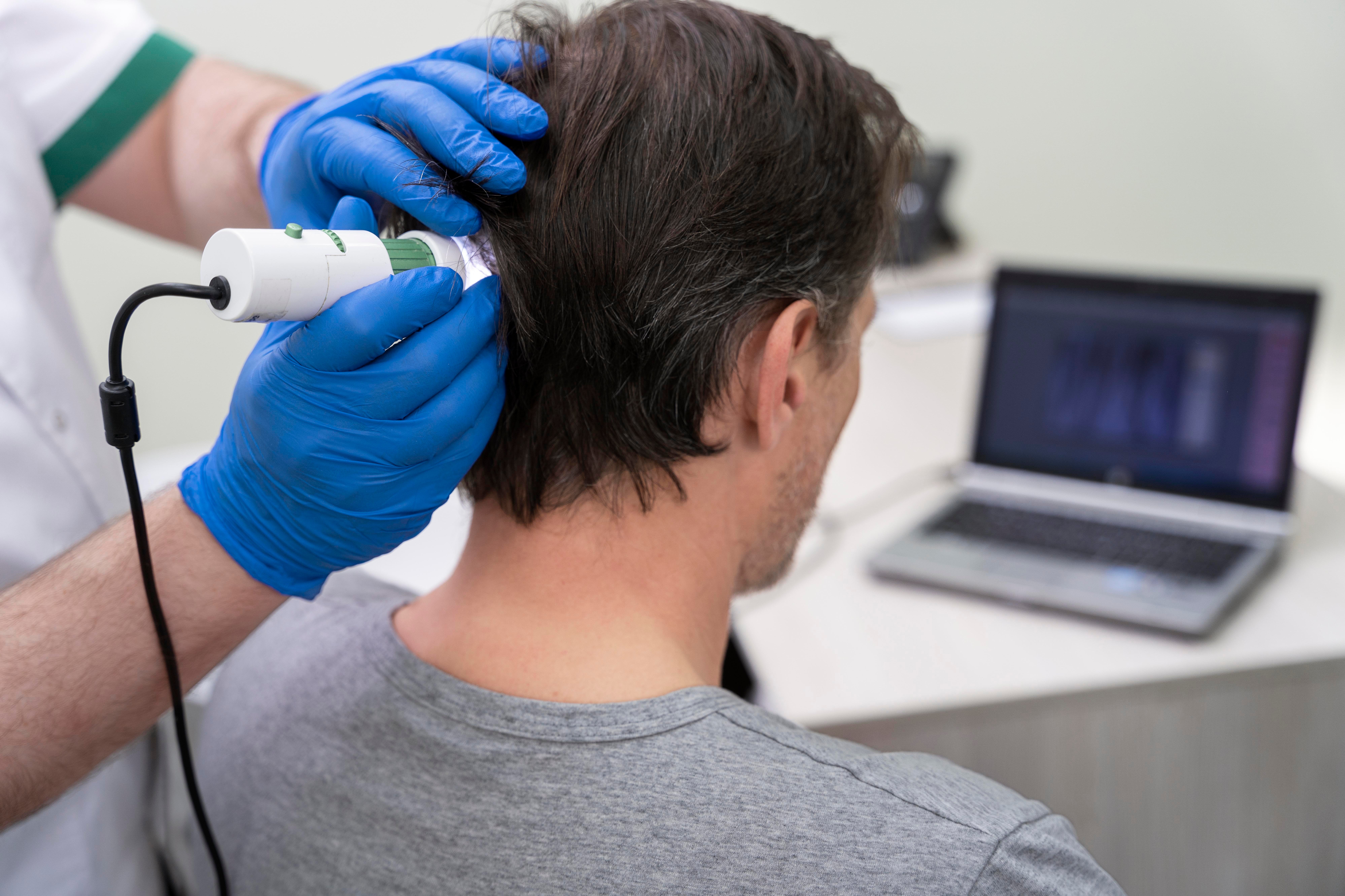 man-getting-hair-loss-treatment