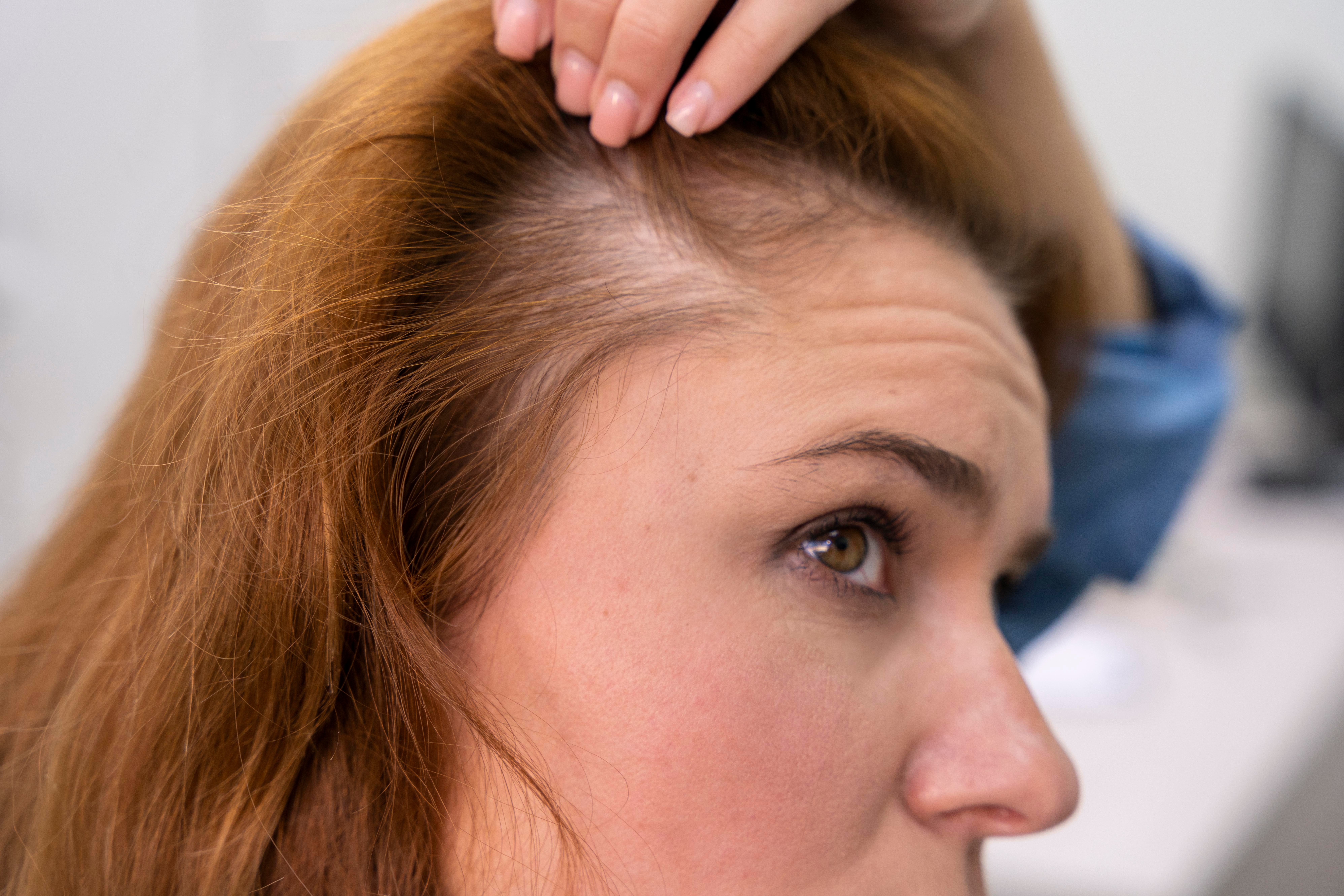 woman-getting-hair-loss-treatment-clinic