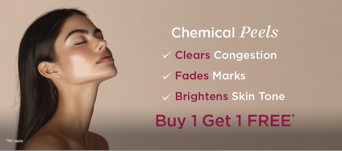 Chemical peel Web banner
