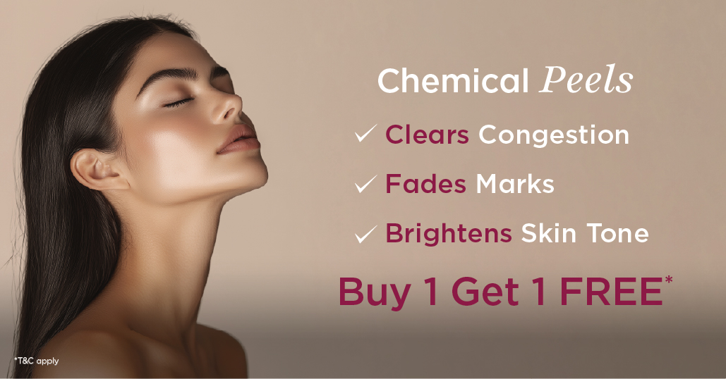 Chemical peel mobile banner
