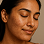 Face Acne & Related concerns