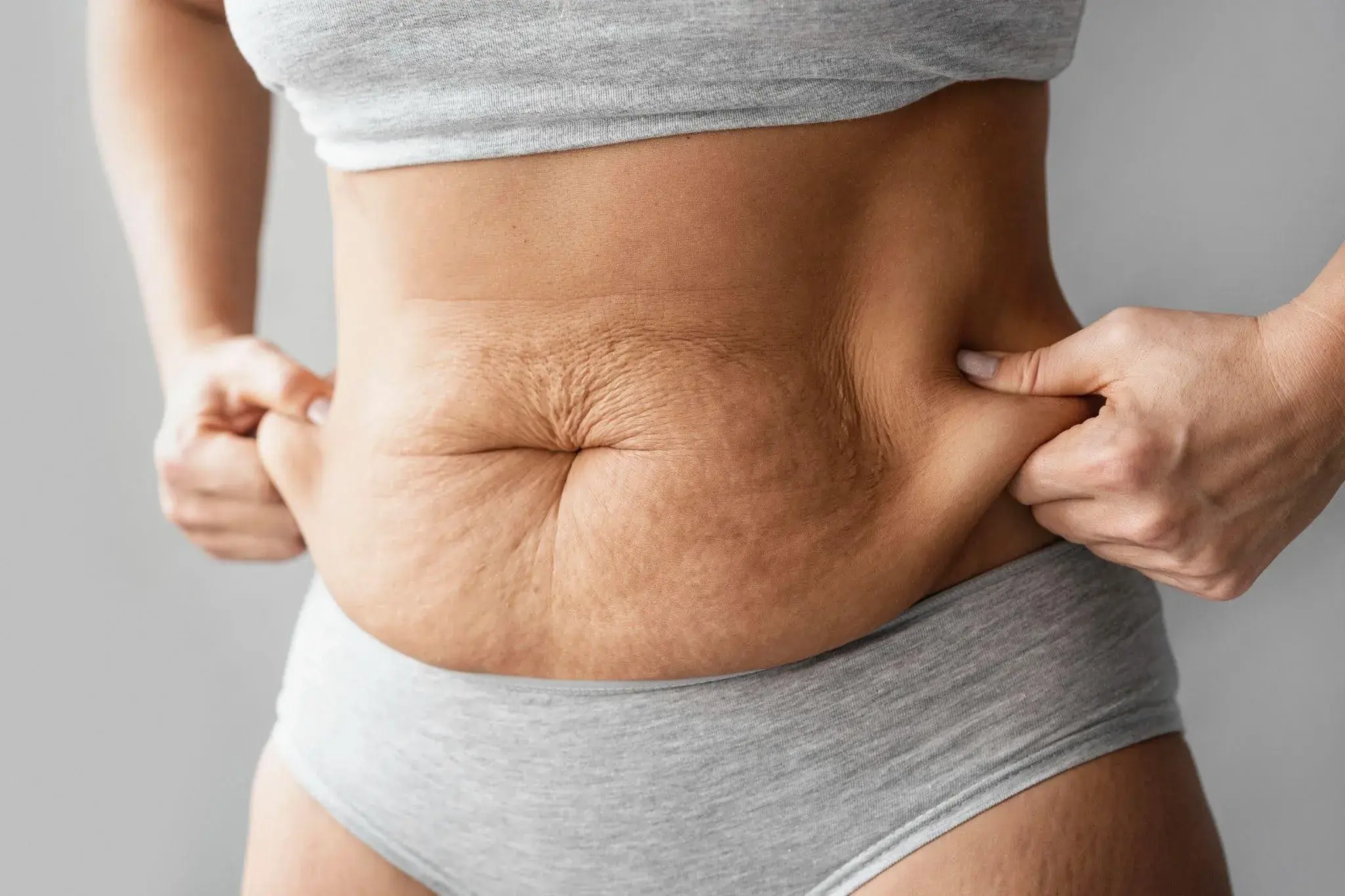 How to Tighten Belly Skin: Treatments & Tips Guide