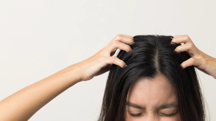 Itchy Scalp: Causes, Treatment & Prevention