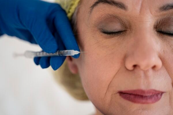 Skin booster injection on face