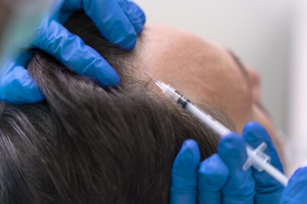gfc therapy