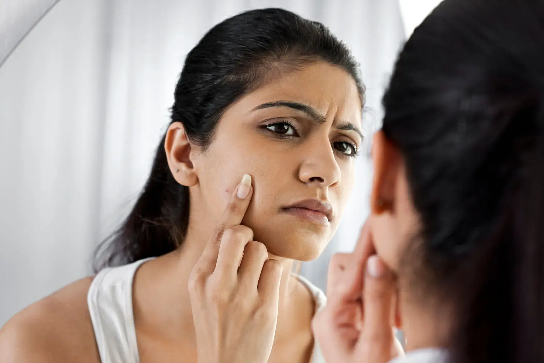 How to Reduce Pigmentation in Summer: Effective Treatments