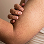 Strawberry Skin (Keratosis pilaris)