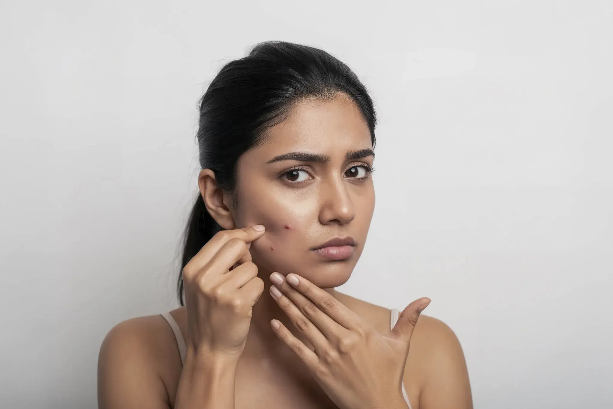 Can Stress Cause Skin Problems?