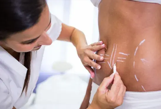 What Is Body Sculpting?