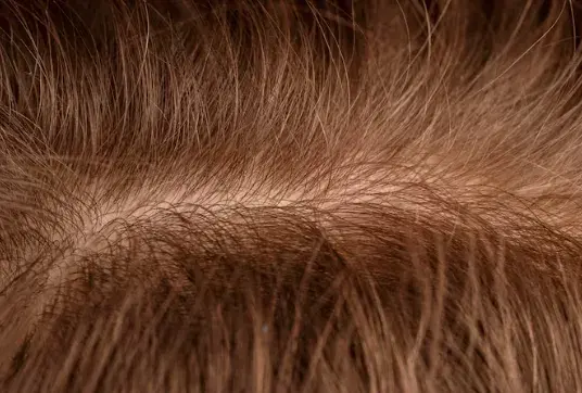 How to Add Volume to Thin Hair: Tips & Treatments