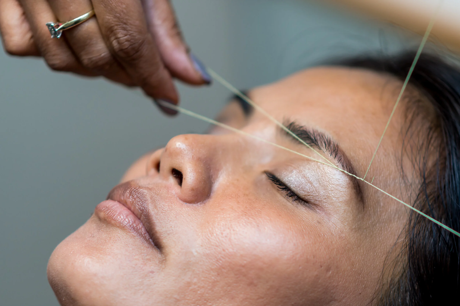How to Cure Pimples After Threading: Quick Home Fixes