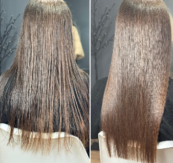 Does Botox Treatment Damage Hair? Myths vs. Facts