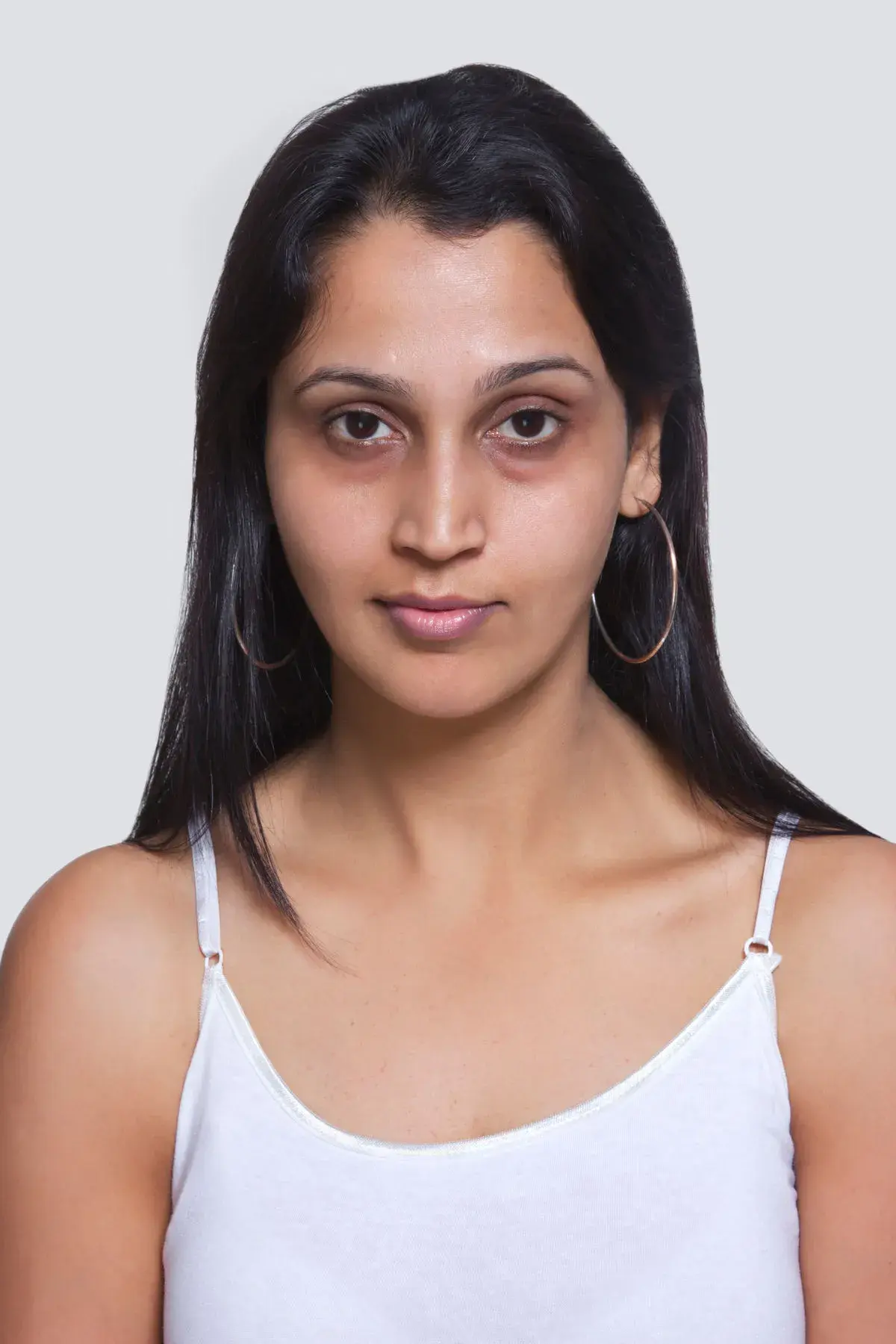 Can Stress Cause Dark Circles?