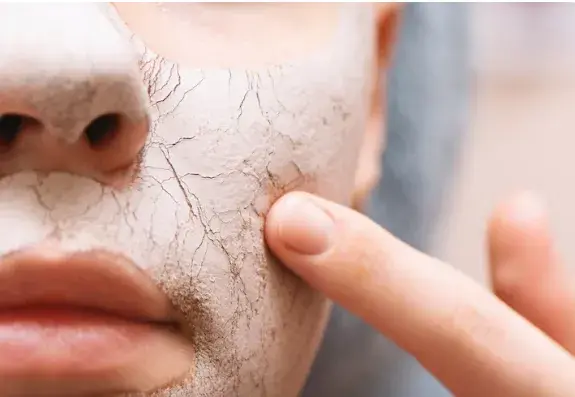 Dry Flaky Skin Doesn't Stand a Chance: Simple Tips That Work