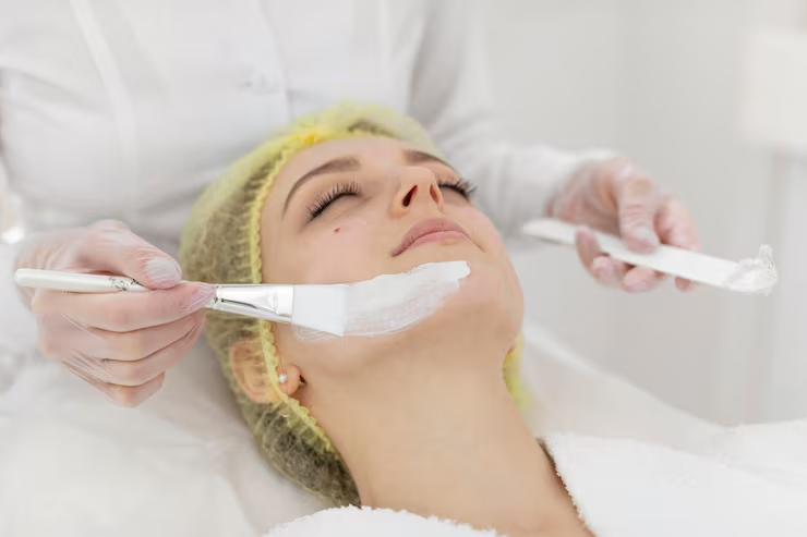 How Does a Chemical Peel Work? Understanding the Science Behind the Glow