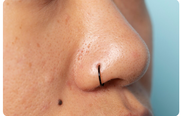Understanding Blackheads on Nose and Face: Causes, Care, and Treatment Options