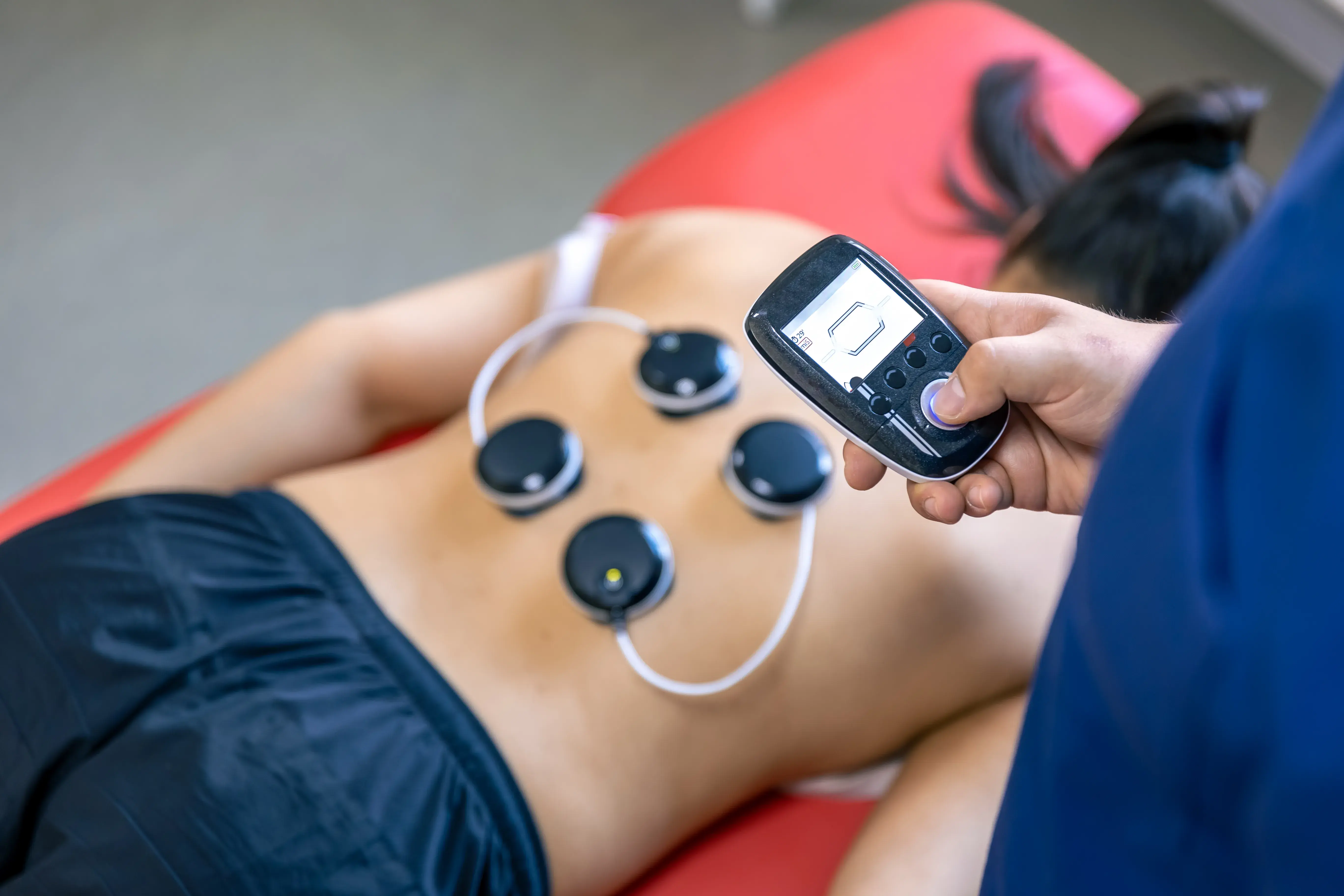 Neuromuscular Electrical Stimulation: Benefits & How NMES Works