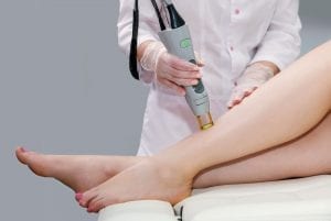 Laser Hair Reduction