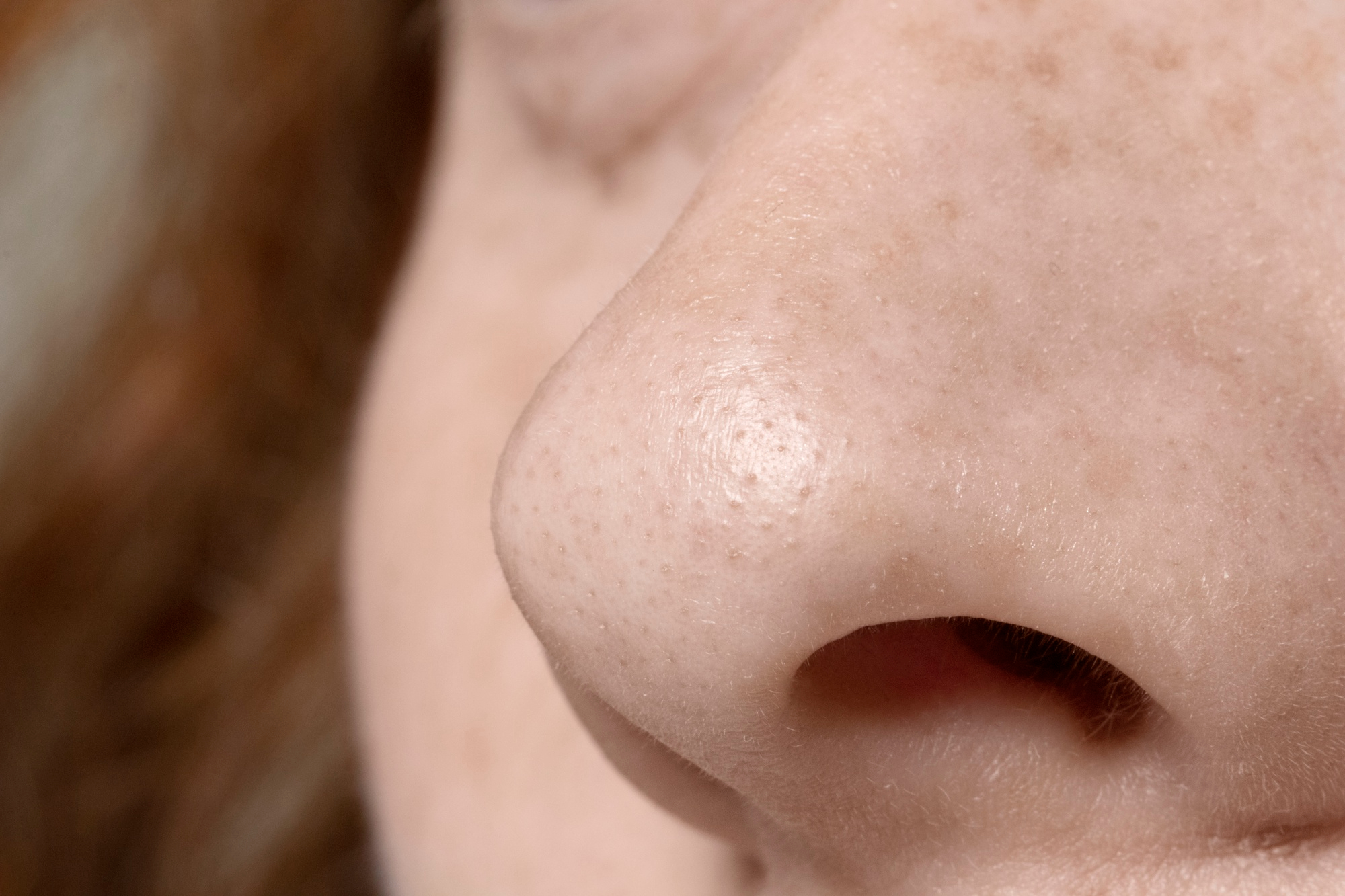 Remove whiteheads from the nose.