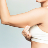 Coolsculpting for Upper Arms