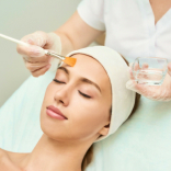 Chemical Peel for Face
