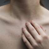 HIFU for Decolletage