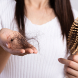 GFC Hair Loss for Excessive Hairfall