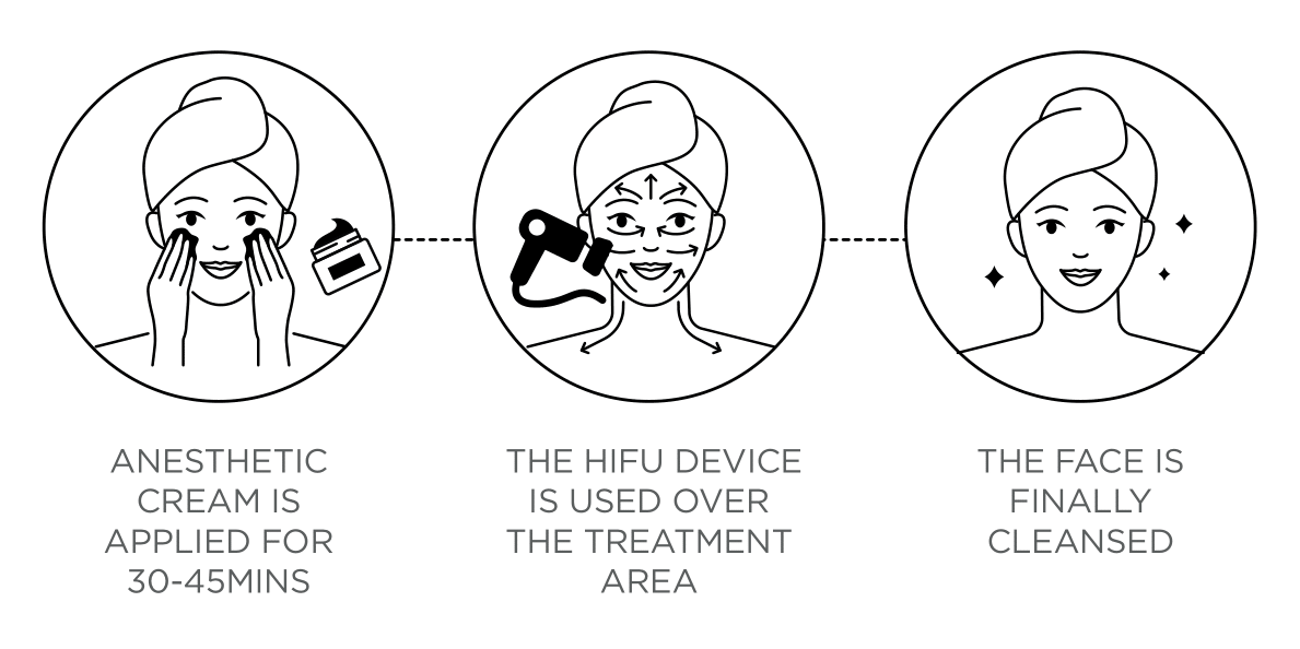 HIFU Skin Treatment Process