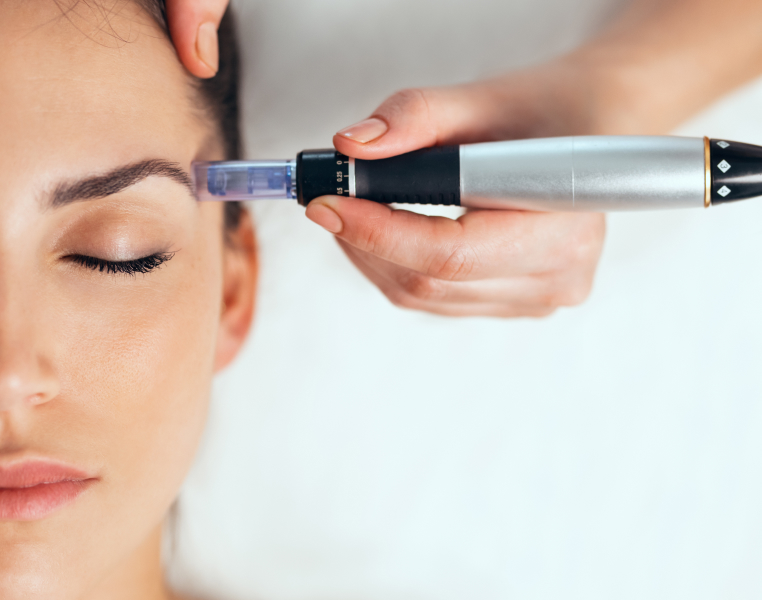 Microneedling with Dermapen Treatment 