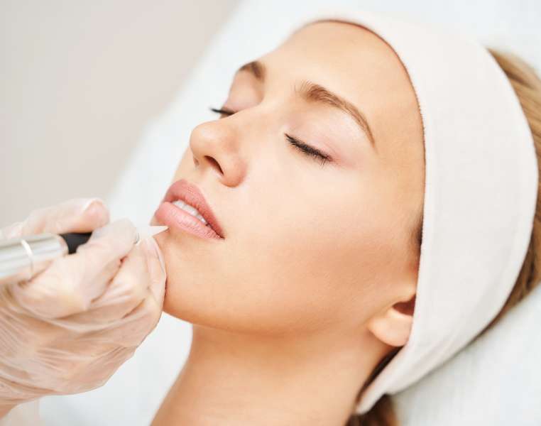 Lip Micropigmentation Treatment