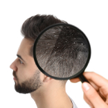 QR678® Hair Treatment for Scalp Dryness Dandruff