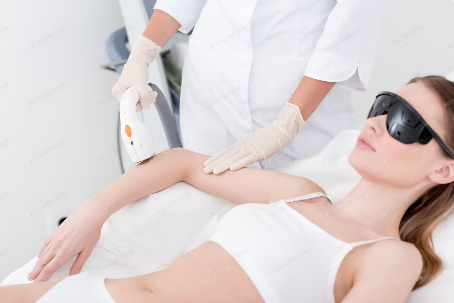 Laser Hair Removal for Arms