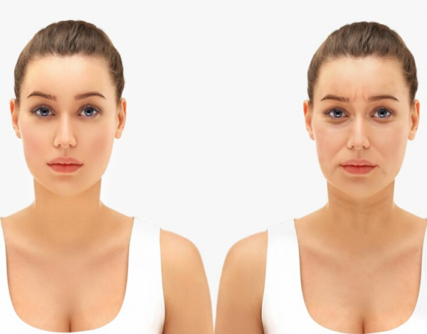 Causes of Frown Lines