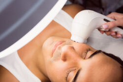 Q Switch Laser Benefits for Face & Body