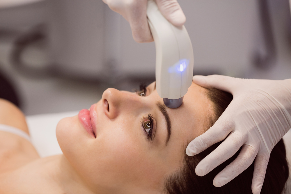 types of laser treatments for face