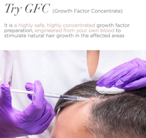 Top Benefits of PRP & GFC Hair Treatments | Bodycraft