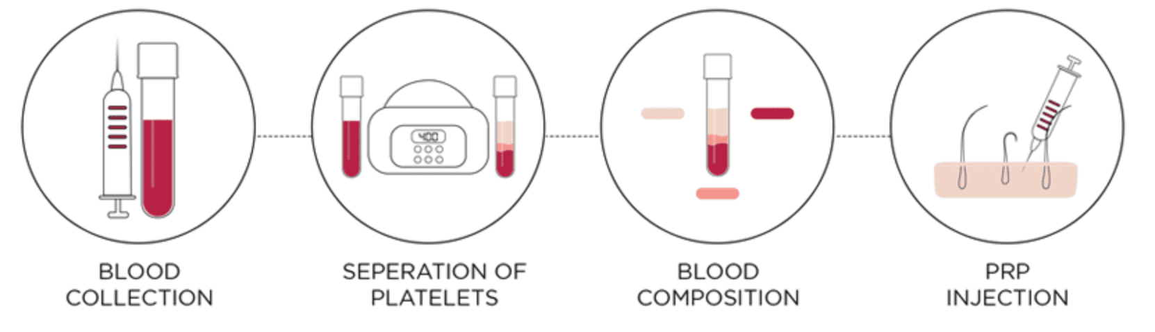 PRP Vampire Facial