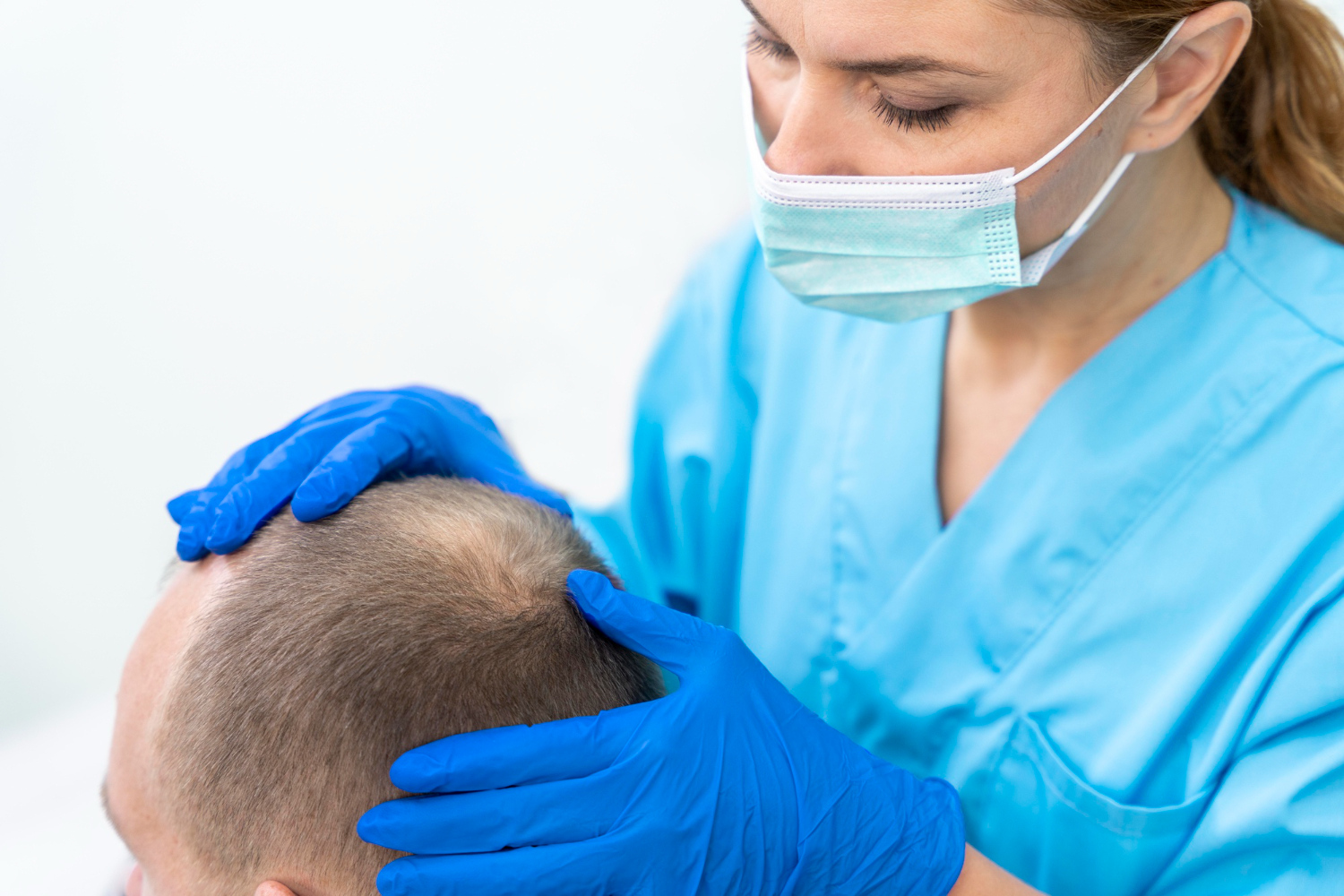 androgenetic alopecia causes