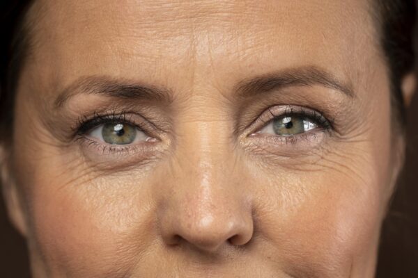 reasons for bags under eye