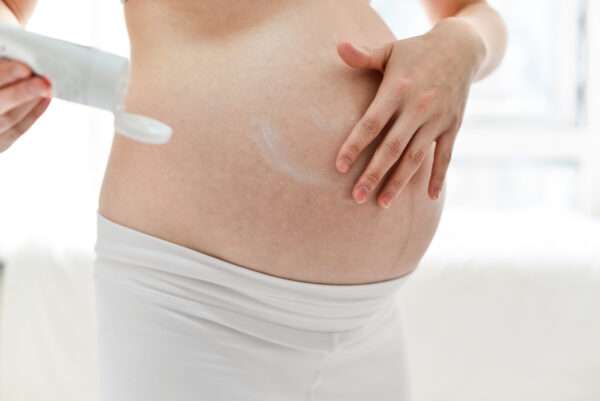 How to remove stretch marks permanently